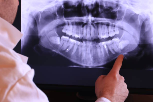 Best Emergency Dental Surgery in Abbeville, AL